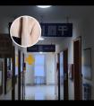 皮肤用激光治疗仪308